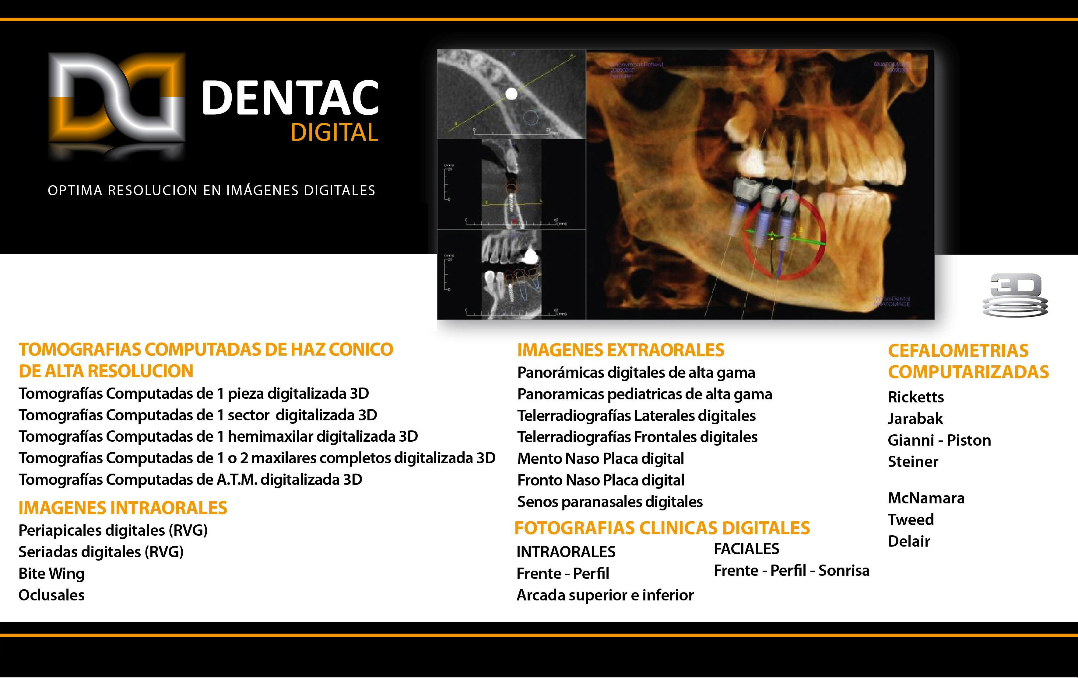  IMAGENES INTRAORALES, Periapicales digitales (RGV), Seriadas digitales (RGV), Bite Wing, Oclusales, Ricketts, Jarabak, Gianni - Piston,Steiner, McNamara, Tweed, Delair, FACIALES, Frente -Perfil, 3/4 Perfil, Sonrisa, INTRAORALES, Arcada superior e inferior, IMAGENES EXTRAORALES, Panoramicas digitales de alta gama, Panoramicas pediatricas de alta gama, Tele radiografias Frontales digitales, Tele radiografias Laterales digitales,  Mento Naso Placa digital, Fronto Naso Placa digital,  Senos paranasales digitales, TOMOGRAFiAS COMPUTADAS DE HAZ CONICO DE ALTA RESOLUCION, Tomografias Computadas de 1 pieza digitalizada, Tomografias Computadas de 1 sector  digitalizadas 3D, Tomografias Computadas de 1 hemimaxilar digitalizada 3D, Tomografias Computadas de 1 o 2 maxilares completos digitalizadas 3D, Tomografias Computadas de A.T.M. digitalizada 3D  	